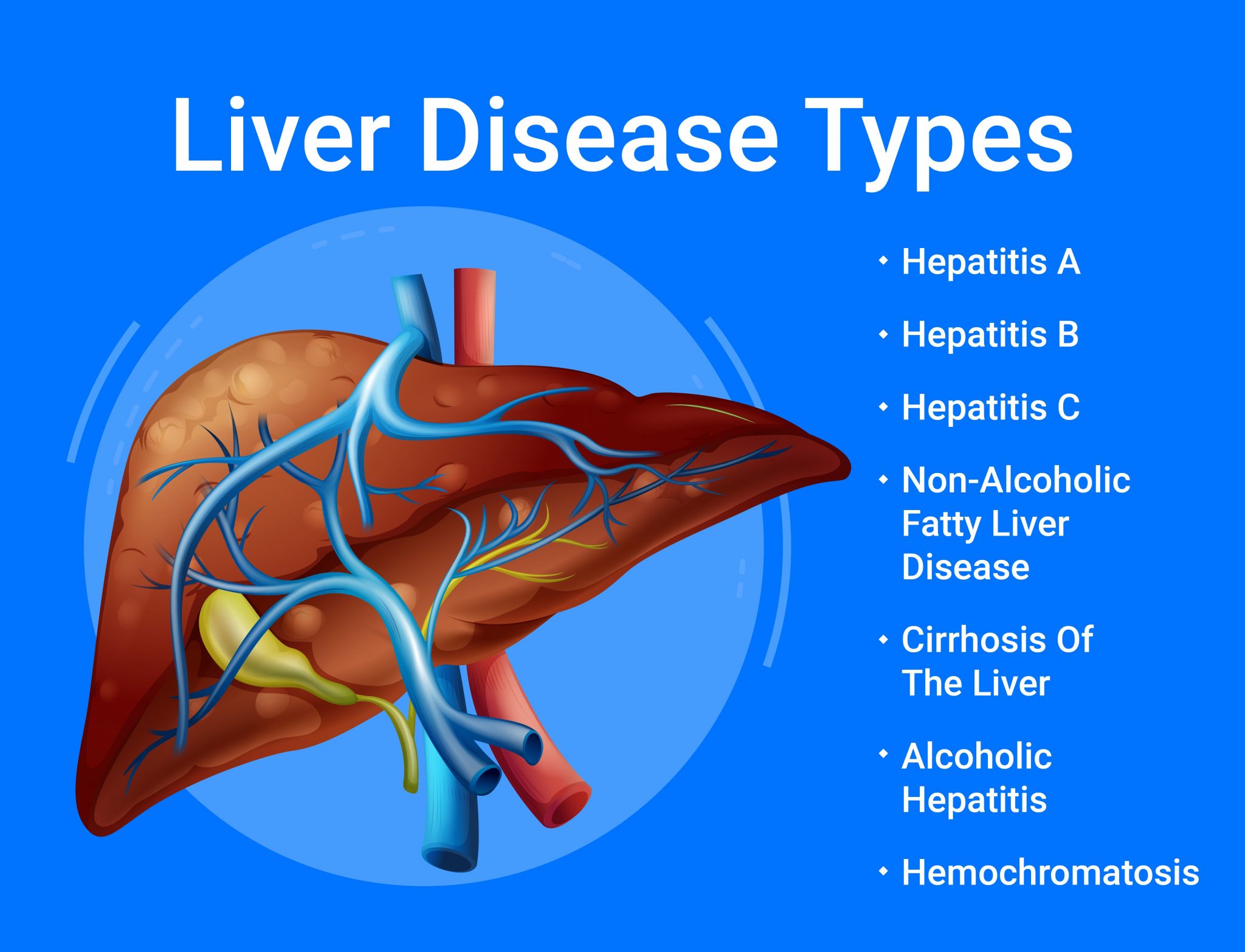 liver-disease-know-everything-raseet-business